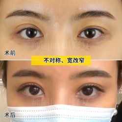 -丰联丽格医疗美容·联合丽格眼整形中心