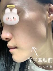 体验前-厦门美莱整形美容医院