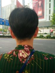 -思密达