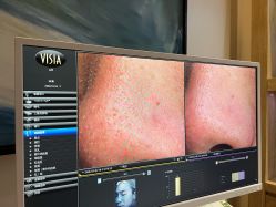 -苑苑vbeauty科技美容SPA