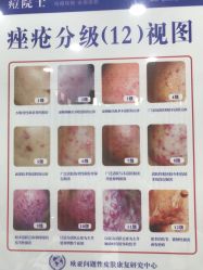 -痘院士专业祛痘皮肤管理