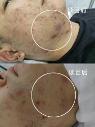 -凡碧诗毛孔收细