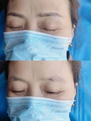 -西施无菌半永久纹绣眉眼影唇轻增发纹发际线
