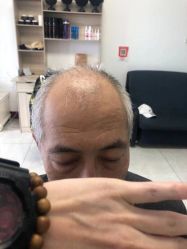 -极客侠男士假发定制补发
