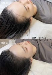 -德绣·机器野生眉发际线·美瞳线半永久