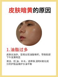 -克丽缇娜