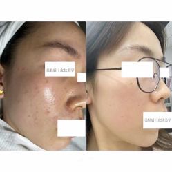 -美肤盾祛痘·问题肌头疗管理中心