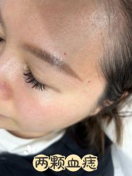 -清疣美疣·痣·斑净肤中心