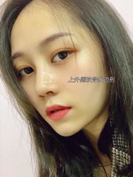 -北京米扬丽格医疗美容·联合丽格鼻整形中心