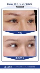 -丰联丽格医疗美容·联合丽格眼整形中心