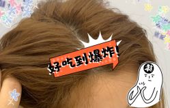 -大麦微针植发全国连锁