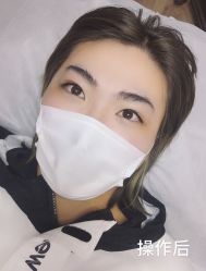 -西施无菌半永久纹绣眉眼影唇轻增发纹发际线