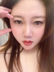 体验后-成都艾特他整形外科医院