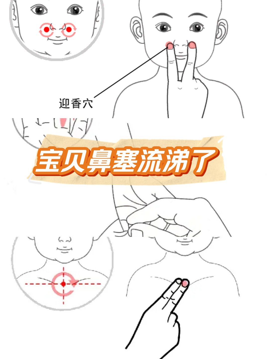 咳嗽,流涕,鼻塞等呼吸道症状,推这几个穴位