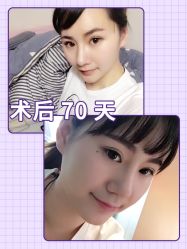 -广东韩妃整形外科医院