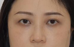 -天津健丽·去眼袋医疗美容机构