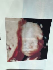 -郑州万安妇产医院