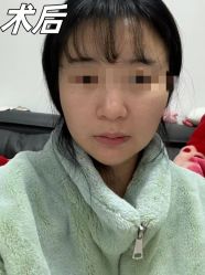 -素美医疗美容·西南眼鼻整形·修复基地