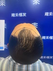 -雍禾植发全国连锁