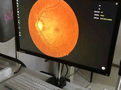 -宝岛眼镜(太原科技街店)