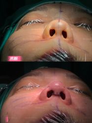 -北京米扬丽格医疗美容·联合丽格鼻整形中心