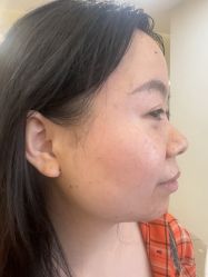 -长沙雅美医疗美容医院