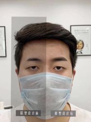 -西施无菌半永久纹绣眉眼影唇轻增发纹发际线