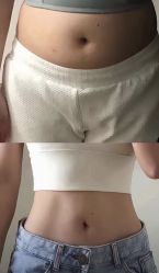 -广州美莱医疗美容医院