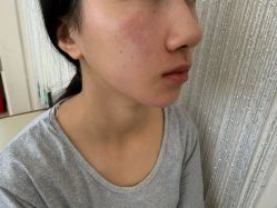 -长沙雅美医疗美容医院