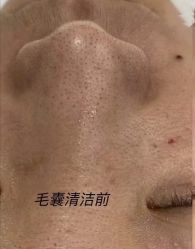 -苑苑vbeauty科技美容SPA