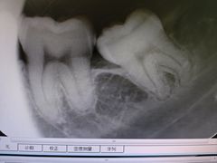 -北京大学口腔医院(第三门诊部)