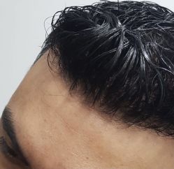 -发饰美男士增发补发假发定制店