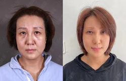 -加减美医美连锁品牌