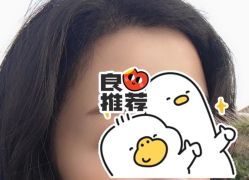 -大麦微针植发全国连锁