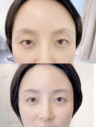 -MIVI半永久纹眉绣眉
