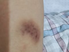 -郑远元专业修脚房(栖山路店)