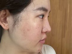 -上海皮肤专科医院