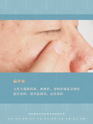 -清疣美疣·痣·斑净肤中心