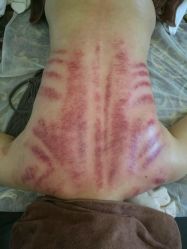 -悦艾堂·中医拔罐减肥·美体艾灸连锁