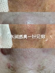 点击看大图 -智丽佳人祛斑祛痘美容美体
