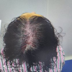 -雍禾植发全国连锁