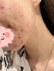 -晶禾臻语·问题肌研究所