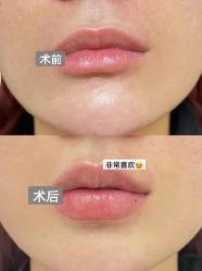 -上海伊莱美医疗美容医院
