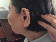斯达克耳背式助听器宝山店-宁耳听力助听器奥迪康·峰力·西门子(宝山店)