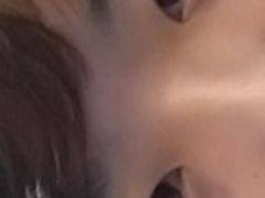 开双眼皮前-上海华安整形外科门诊部