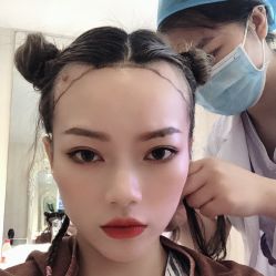 -碧莲盛·不剃发植发