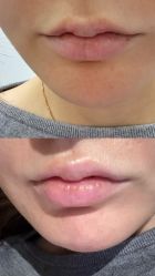 -洁铭新加坡医美