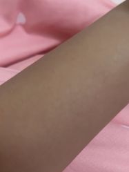 -MUSES专业脱毛比基尼サロン日式连锁