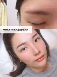 -MLP美丽派·问题肌疗愈中心