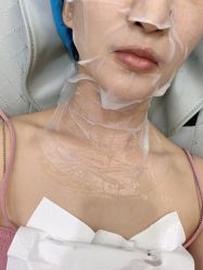 体验后-美瑞莎创美医疗美容